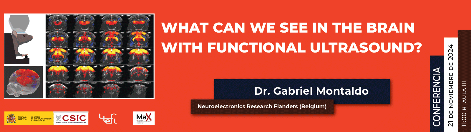 Conferencia. What can we see in the brain with functional ultrasound?