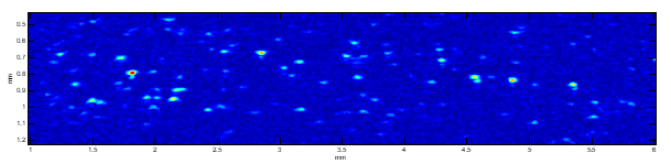Microechography of a suspension of 400 neutrophils / µl in PBS performed with a scanning system centered at 50MHz. 5 µm lateral pitch, 313MHz axial sample rate